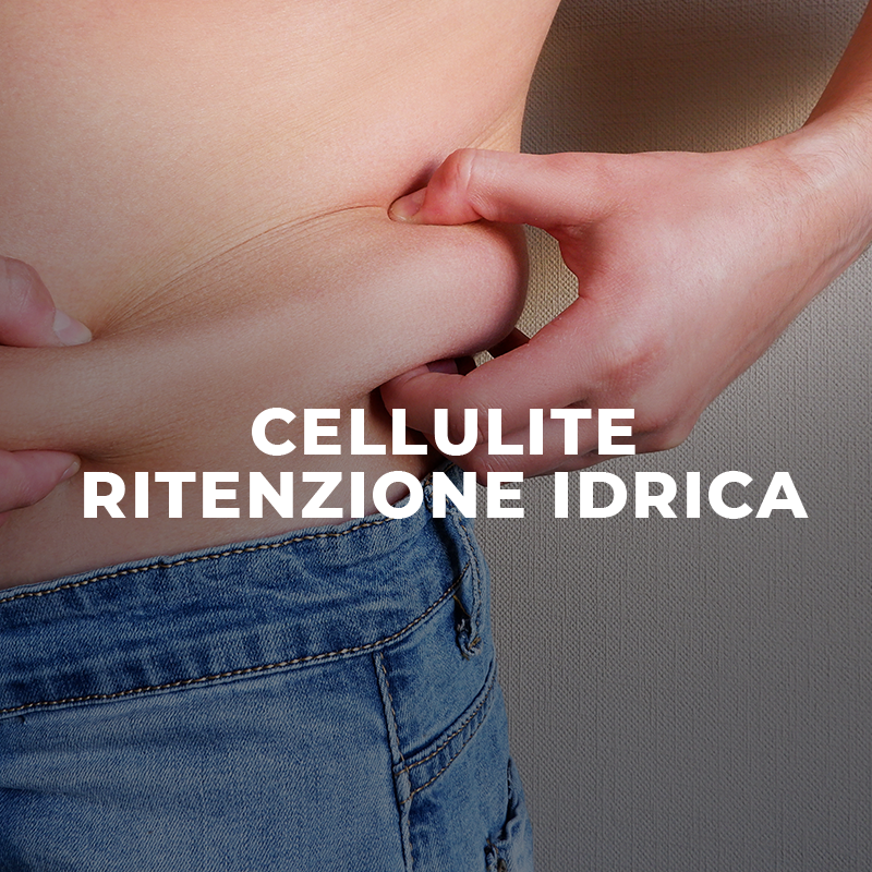 Rétention d'eau par la cellulite chez l'homme